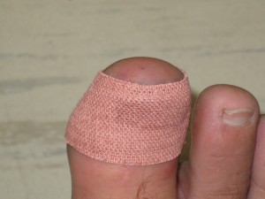 Ken Bob's bandaged stubbed toe (2009 November 4) Long Beach CA