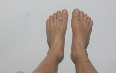 4 weeks after broken 5th metatarsal - right foot