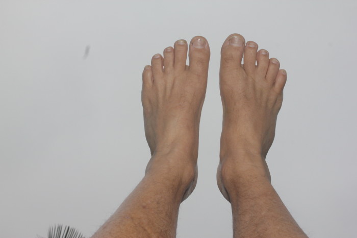 4 weeks after broken 5th metatarsal - right foot